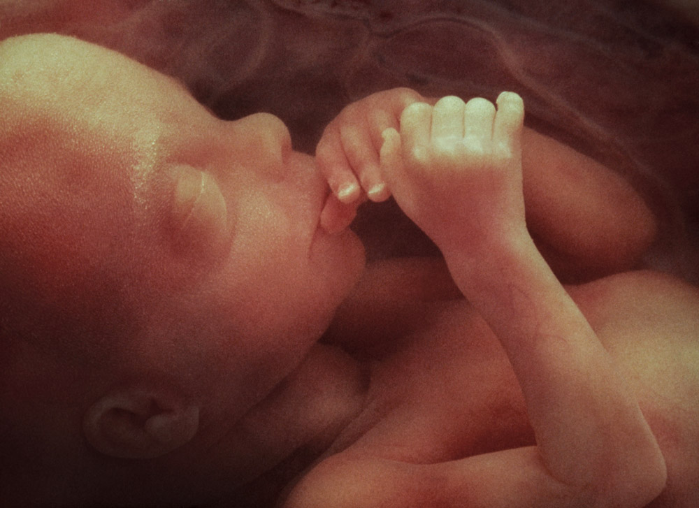 foetus radio en 3d